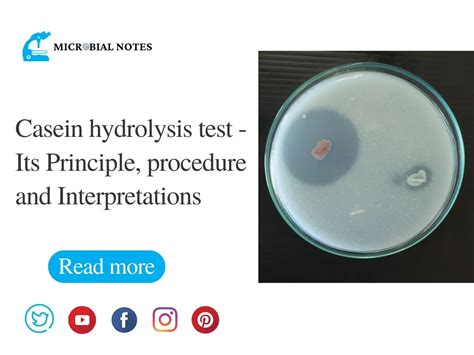 casein hydrolysis test|Casein Hydrolysis Test .